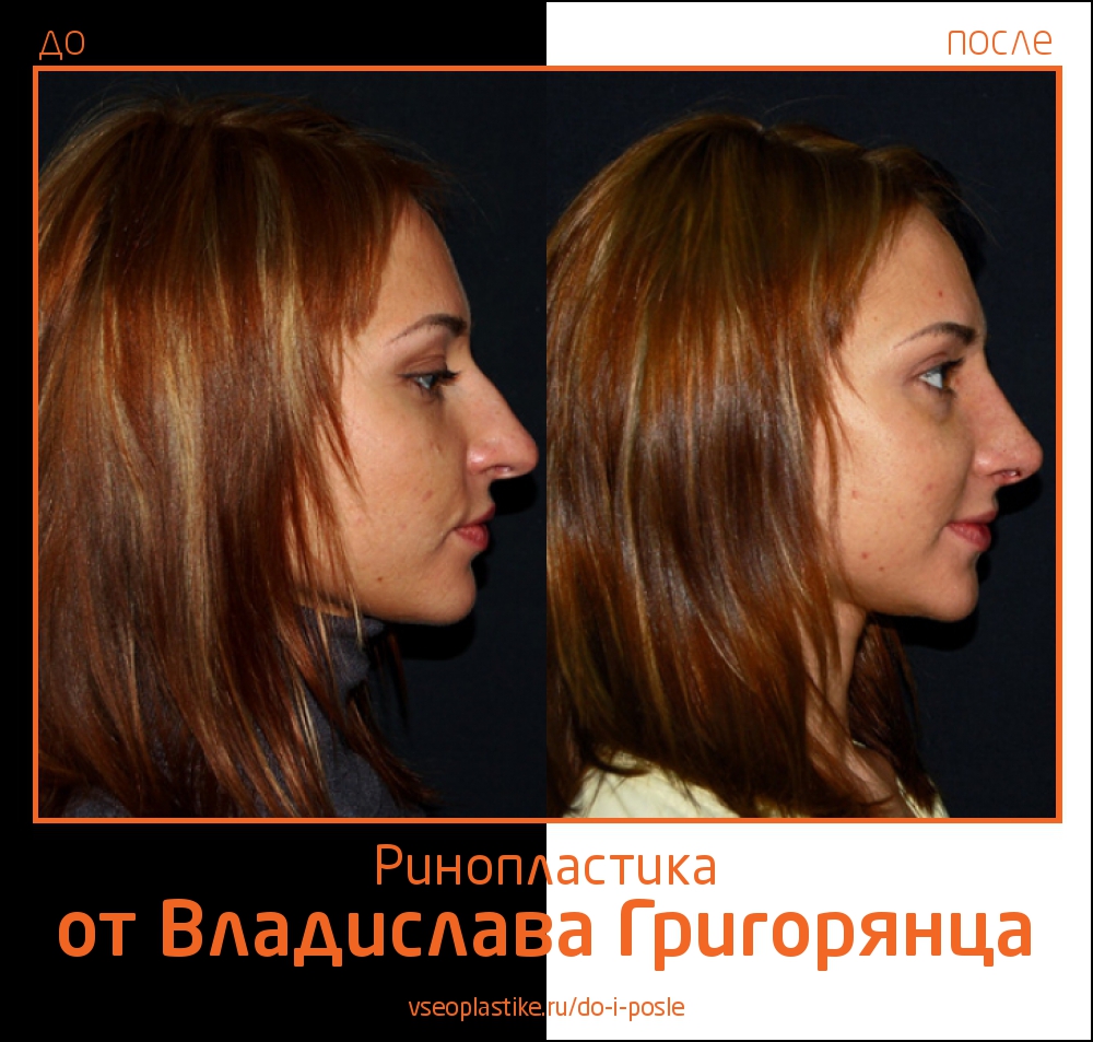 Григорянц Пластический Хирург