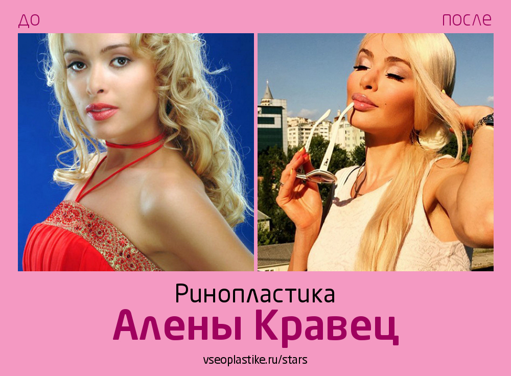 Голая Алена Кравец