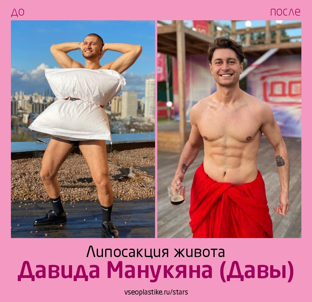 Дава до и после операции