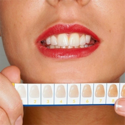 Как отбелить зубы в домашних условиях за 5 минут?