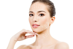 Фейслифтинг