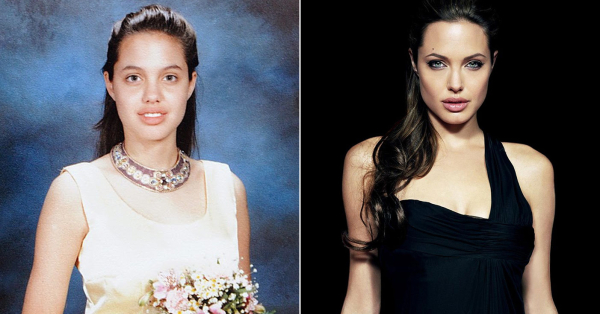 Пластические операции Анджелины Джоли