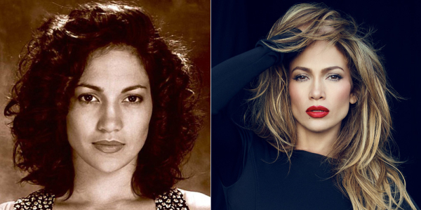 Пластические операции Дженнифер Лопес