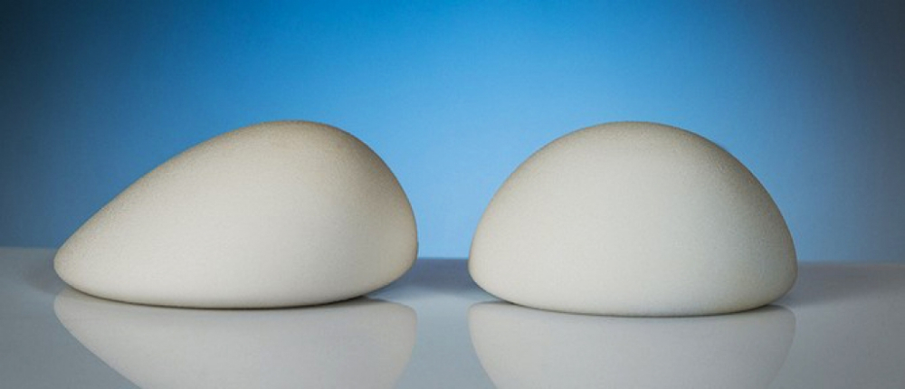 Импланты для увеличения груди B-Lite