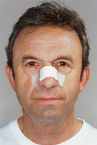 Ринопластика для мужчин