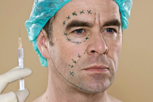 Блефаропластика у мужчин