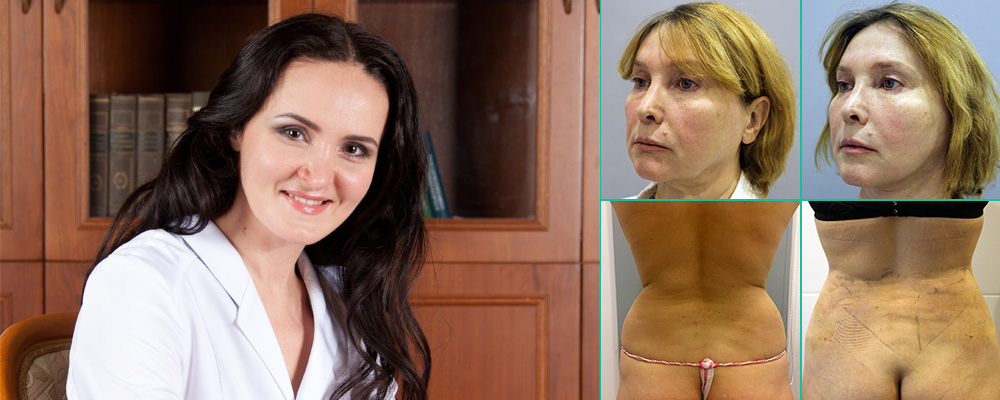 Липофилинг лучший хирург Олеся Андрющенко