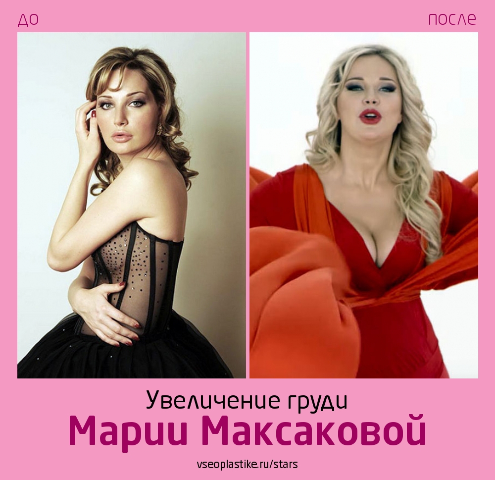 Мария Максакова до и после пластики