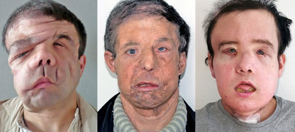 Три лица Жерома Амона