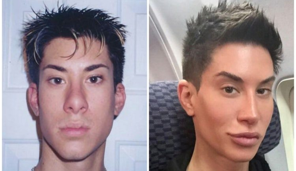 Джастин Джедлика (США)