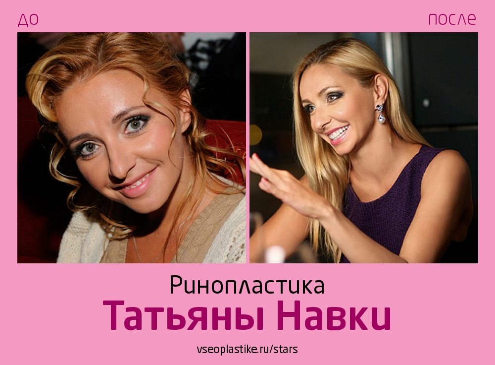 Инстасамка с мужем показали лица после пластики: Внешний вид: Ценности: security58.ru
