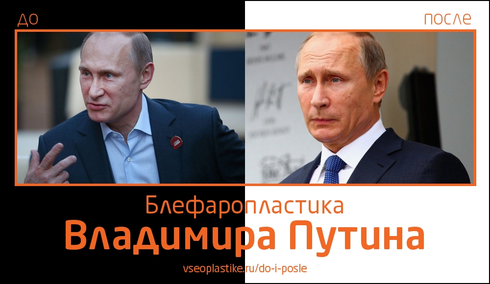 Путин До И После Пластики Лица Фото