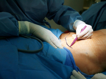 Абдоминопластика цена Москва