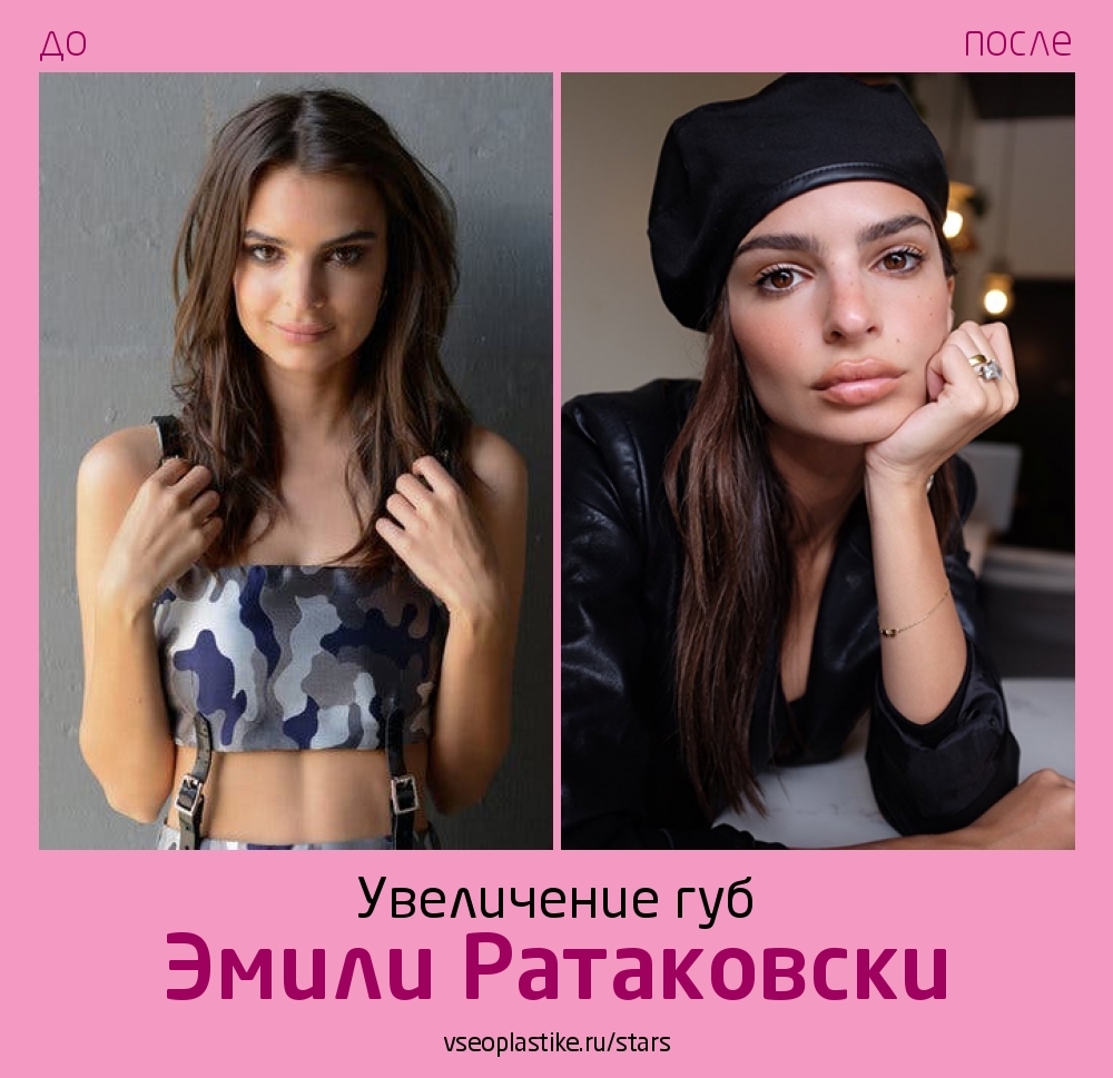 Воплощение секса: Самые горячие фото Эмили Ратаковски. Metro