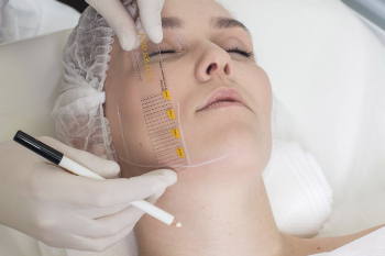 Ультразвуковая подтяжка лица