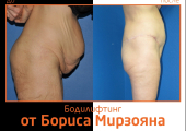 Борис Мирзоян. Фото до и после бодилифтинга