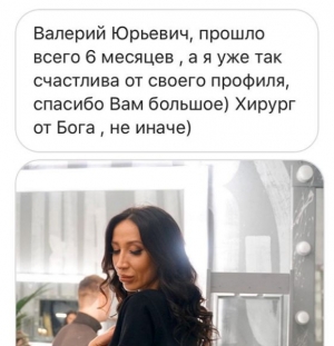 Фото до и после ринопластики у доктора Стайсупова