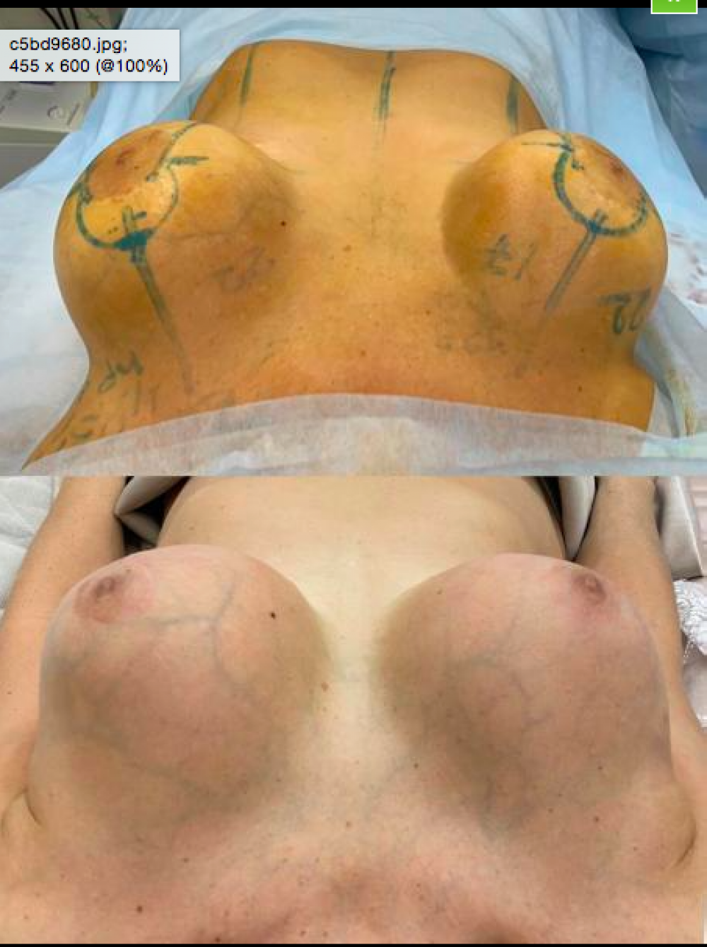операция на голых женщинах фото 84