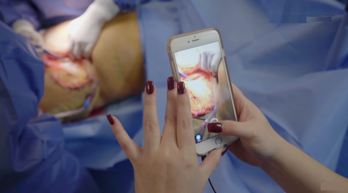 Достоверность видео пластических операций