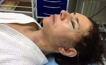 Андрей Михайлов блефаропластика