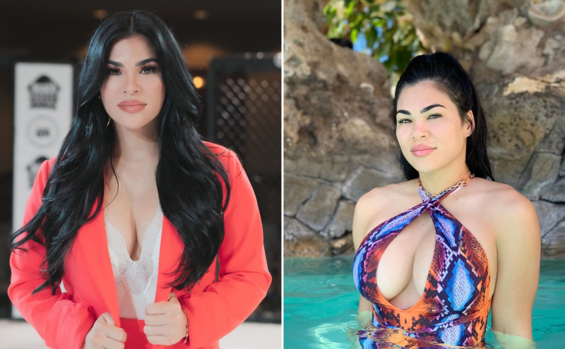 Рэйчел Остович после увеличения груди