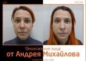 Николай анатольевич до и после пластики