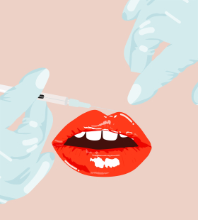 Увеличение губ без филлеров