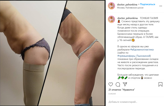 Инстаграм пластического хирурга Светланы Пшонкиной