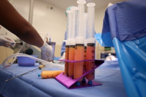 Плюсы и минусы липофилинга груди