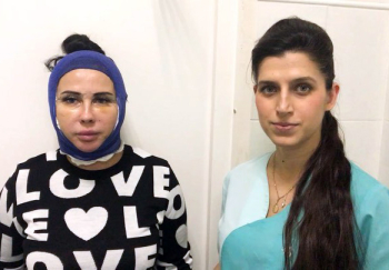 Ольга Ованесова подтяжка лица