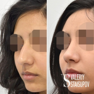 Стайсупов рино фото