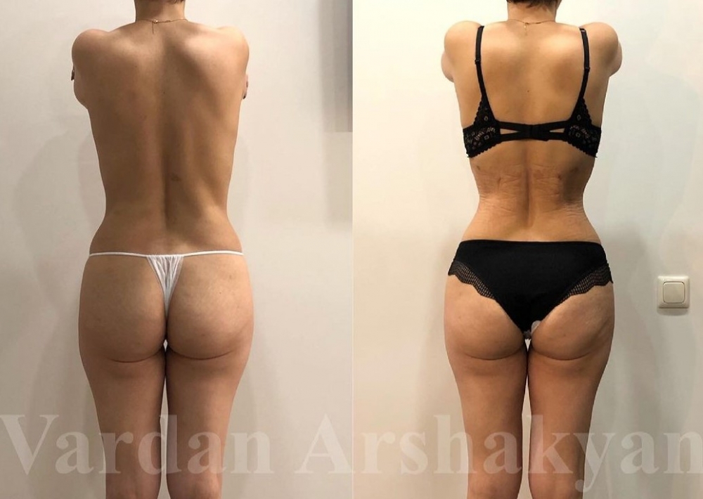 Узкая талия Казбек Кудзаев