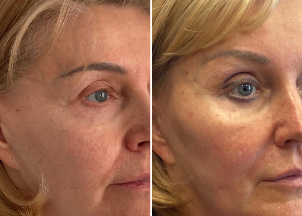 Визаж Лифт Светлана Пшонкина цена