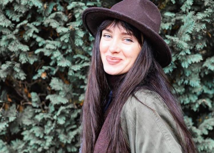 Пациентка доктора Валерия Стайсупова после ринопластики