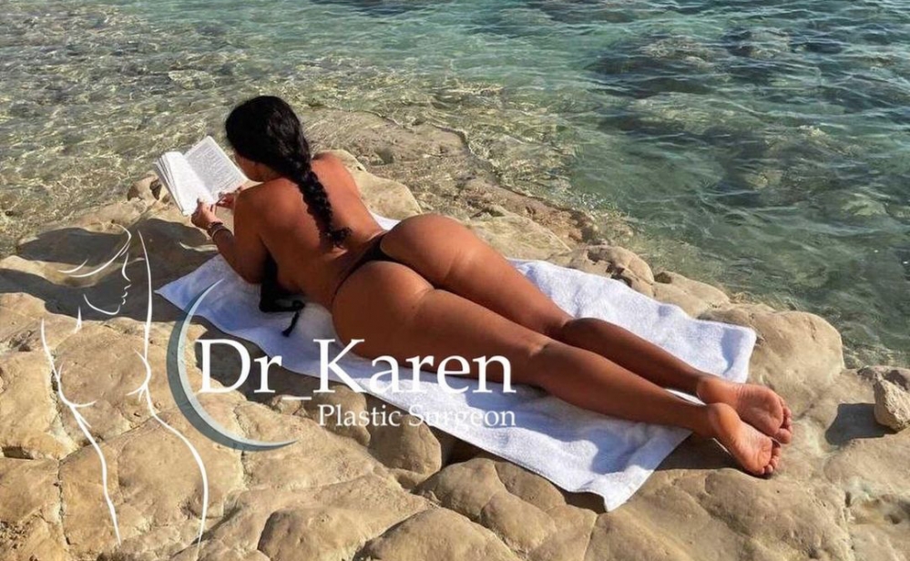 Пациентка доктора Карена Пайтяна через 1 год после липомоделирования тела и увеличения ягодиц