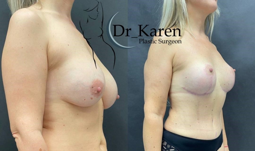 Пластический хирург Карен Пайтян