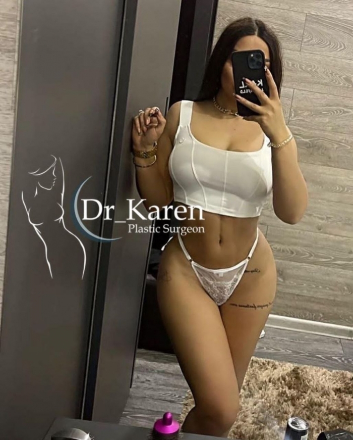 Пациентка пластического хирурга Карена Пайтяна после липомоделирования тела с увеличением ягодиц