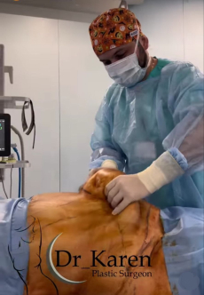 Пластический хирург Карен Пайтян