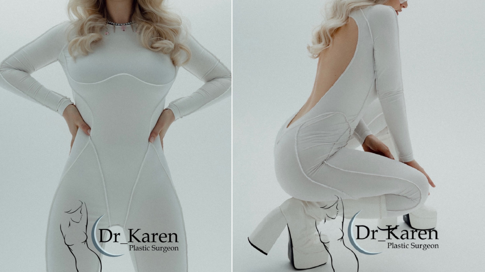 Пациентке выполнено липомоделирование тела с увеличением ягодиц, а также увеличение груди