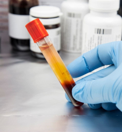 5 преимуществ плазмотерапии