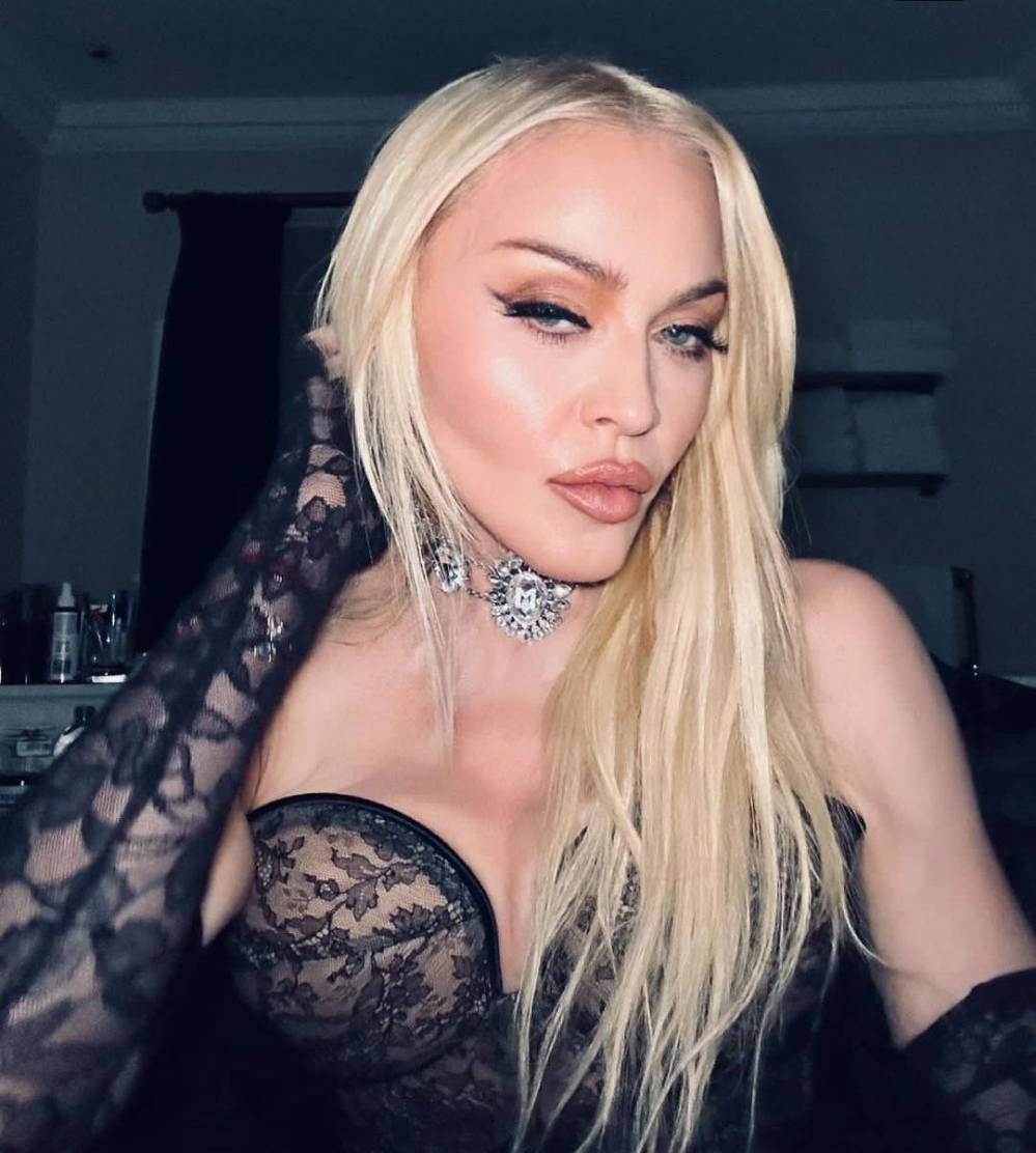 Поклонники умоляют Мадонну «прекратить пластические операции»