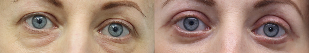 Александр Жуков блефаропластика