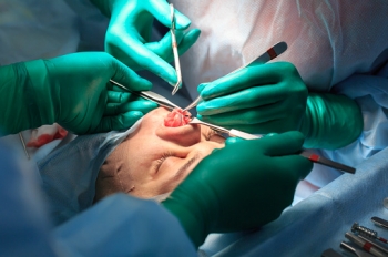 Исчезнет ли шрам после ринопластики?