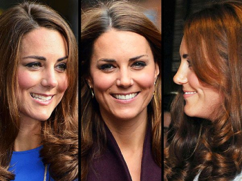 Ринопластика Кейт Миддлтон