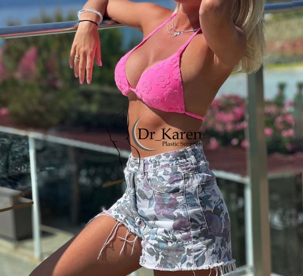 Пациентка Карена Пайтяна после увеличения груди имплантами. Фотоотзыв