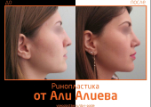 Aliev_rino_1